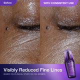 LIPOSOME Advanced Repair Serum 50ml Limited Set