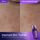 LIPOSOME Advanced Repair Serum 50ml Limited Set