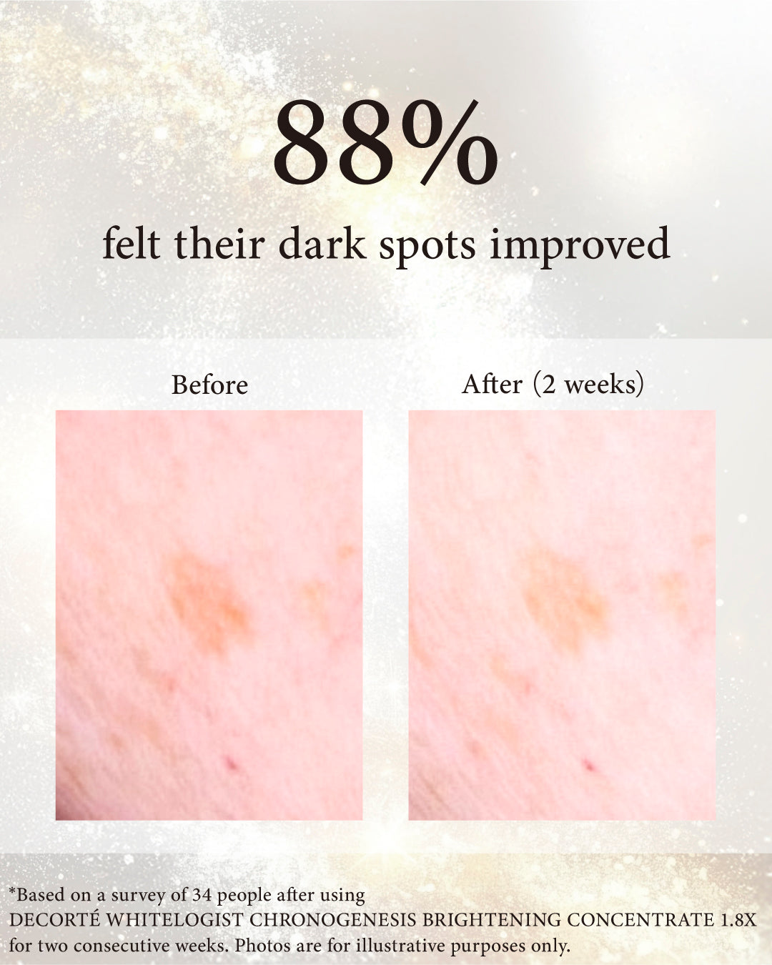 WHITELOGIST Chronogenesis Brightening Concentrate 1.8x – Decorte